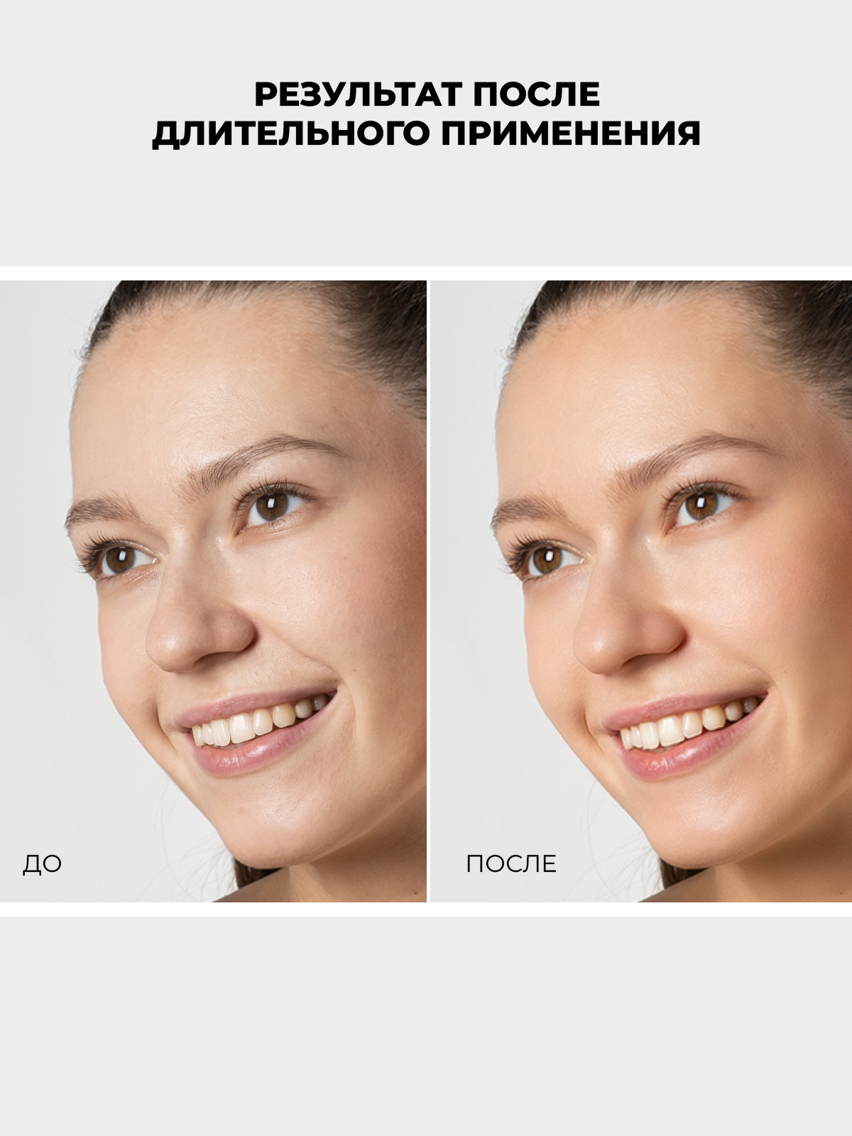 Набор солнцезащитный "ЛЕТНИЙ УХОД ЗА КОЖЕЙ SPF50"